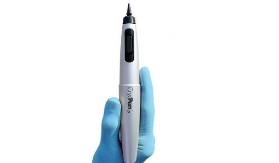 CryoPen - Sanacija bradavic na stopalih