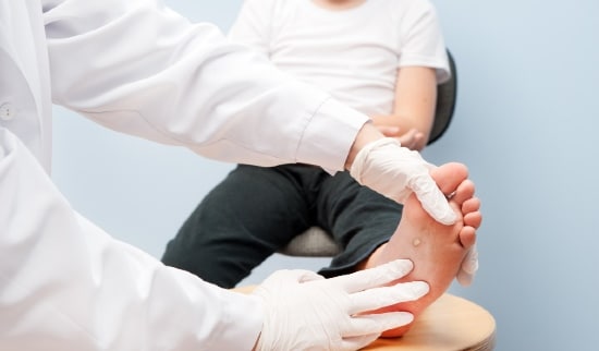 saniramo bradavice na stopalih