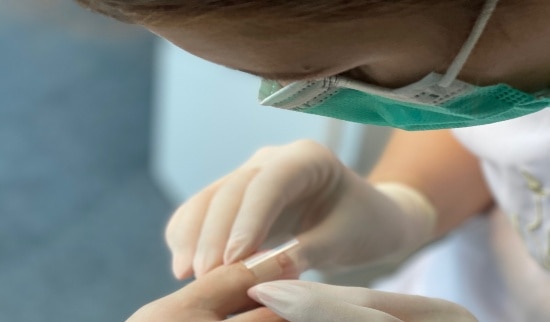 proces nohtne protetika - 3